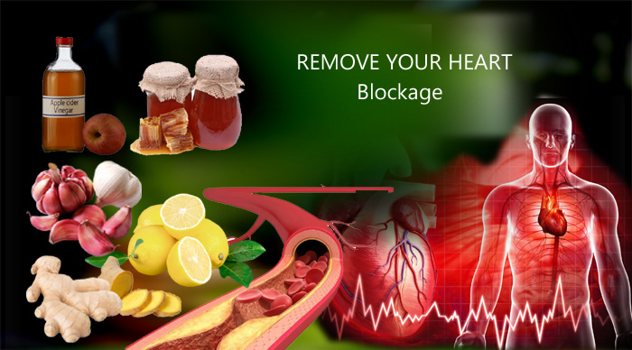 Effective Herbal Remedies to Remove Heart Block